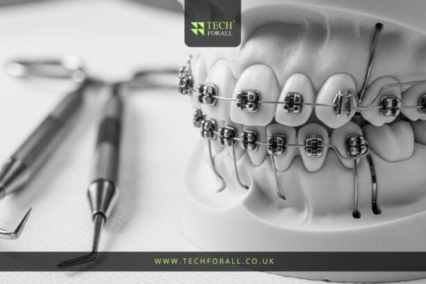 Temporary Anchorage Device A Modern Solution in Orthodontics